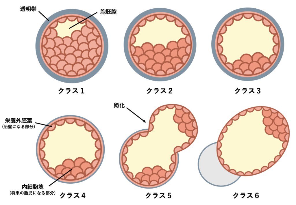【胚盤胞】グレード（Gardner；ガードナー分類）について解説します。